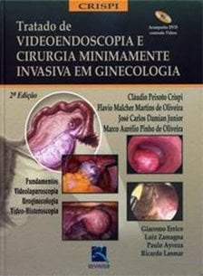 Videolaparoscopia em Ginecologia